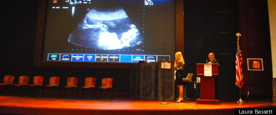 Antiabortion Ultrasounds