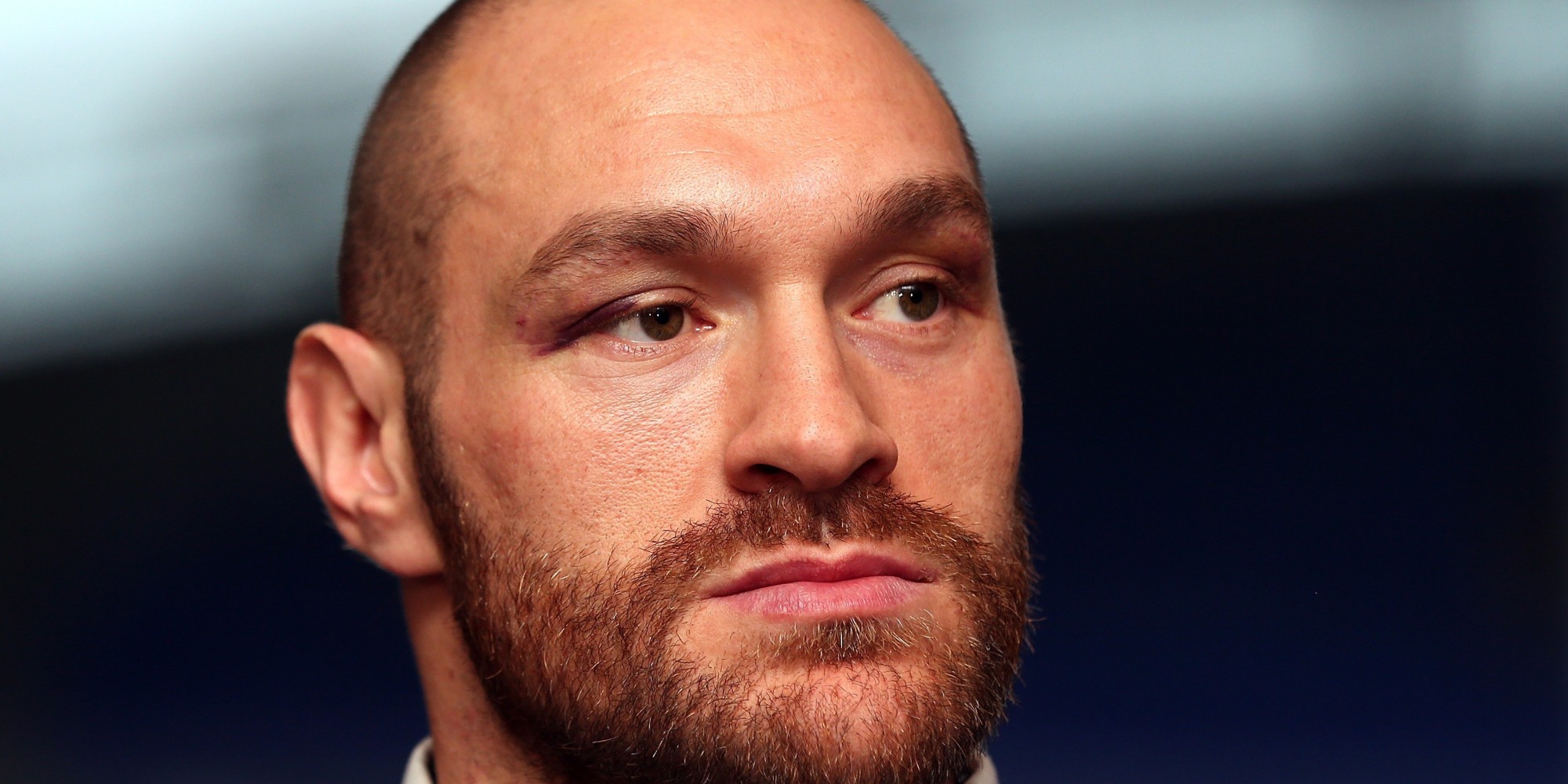 Tyson Fury: BBC Journalist Andy West Suspended For Criticising Sports Personality Of ...