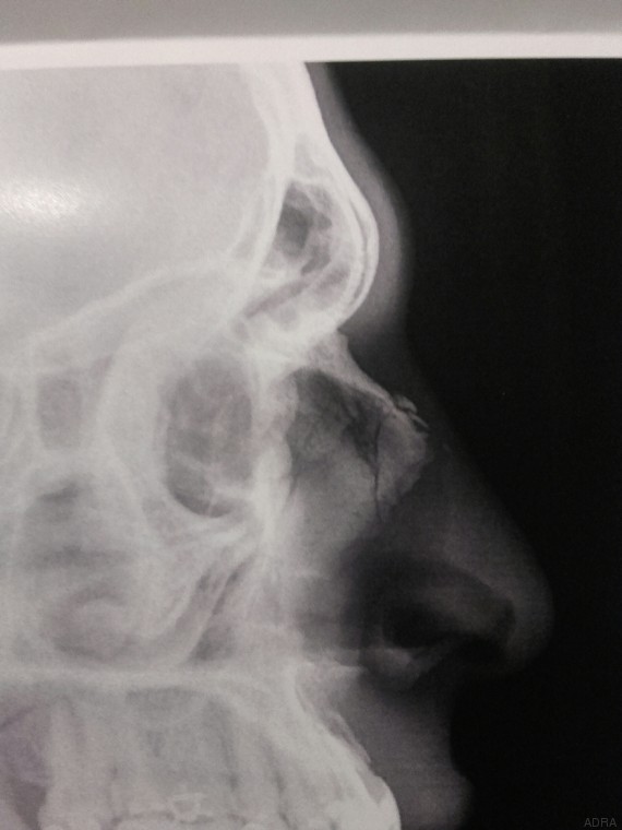 France aux consulats d'Algérie, des ressortissants algériens sont