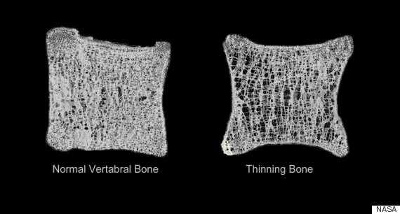 Timothy Peake: Five Ways The UK Astronaut's Body Will Change While