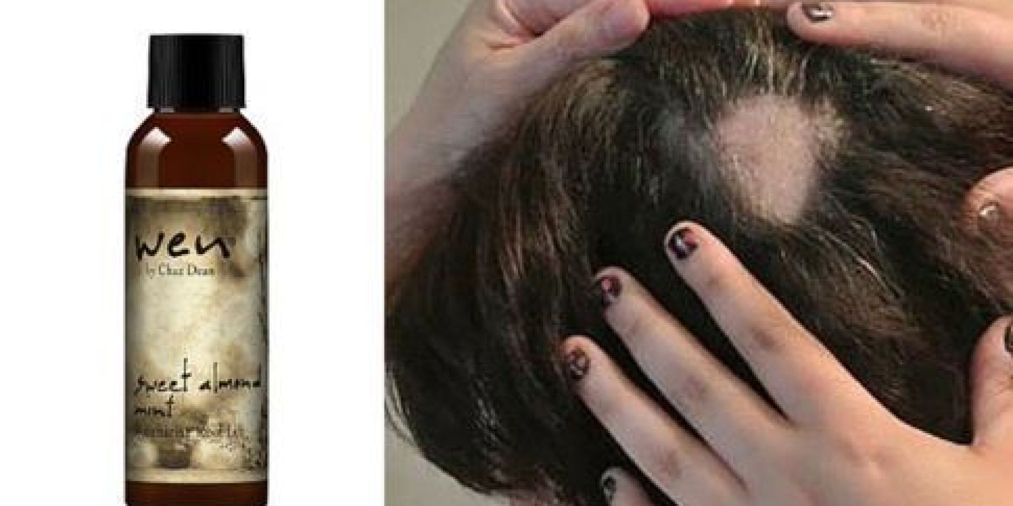 Tipi di procedure per una ricostruzione di capelli