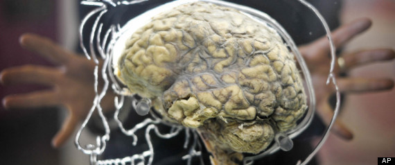 Brain