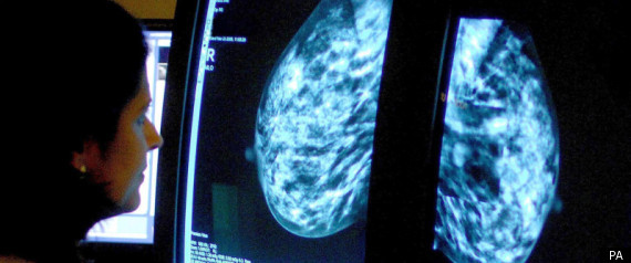 Breast Cancer Screening