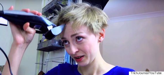 Woman With HairPulling Condition Trichotillomania Shaves Head In Brave