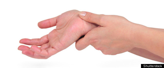 Arthritis