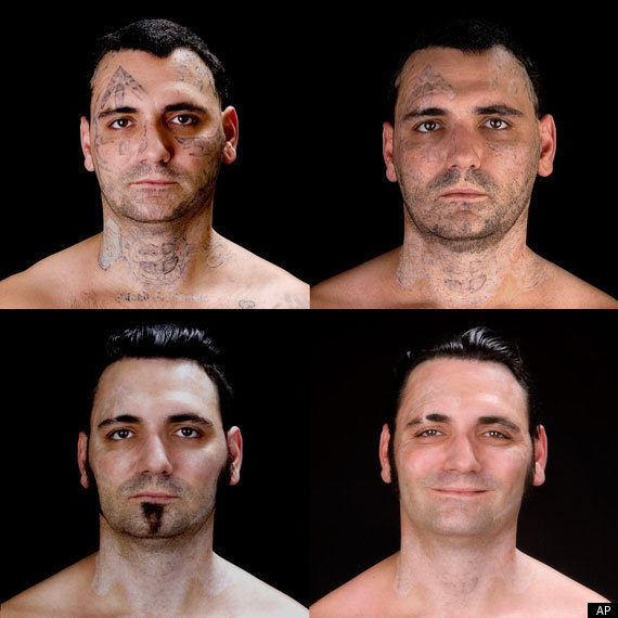 former white supremacist undergoes radical tattoo removal former white supremacist undergoes radical tattoo removal
