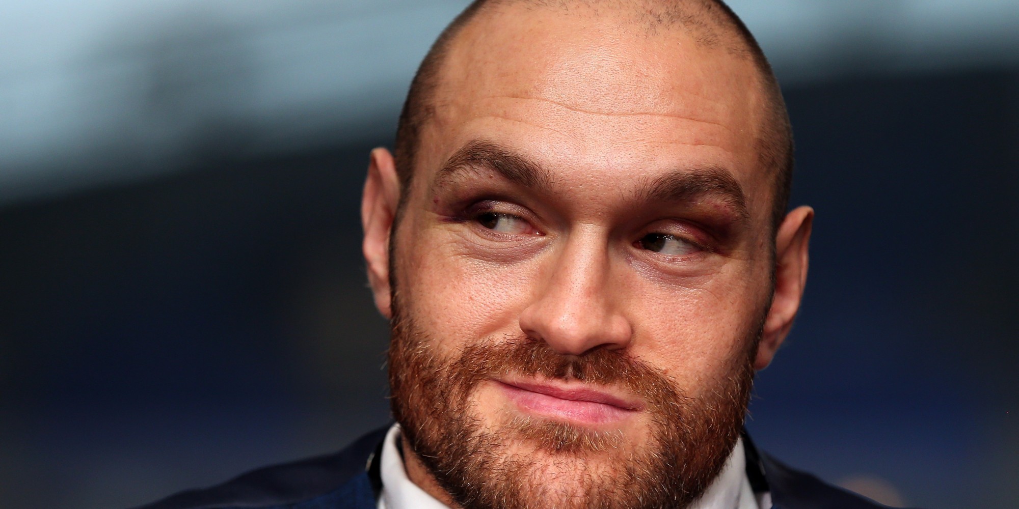 Tyson Fury Receives No Punishment For Controversial Remarks About Women