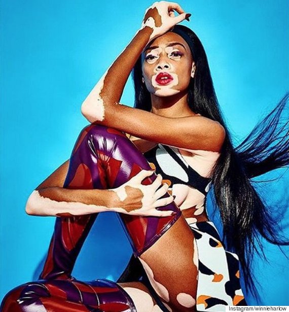 winnie harlow