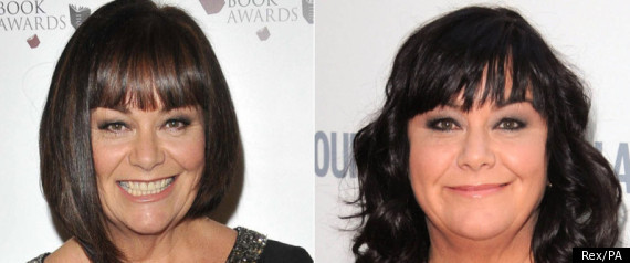 Dawn French