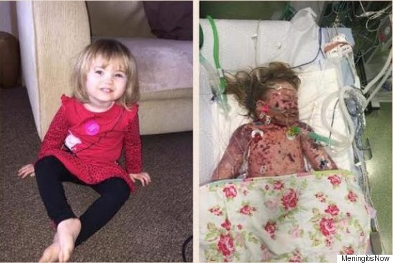 Meningitis Petition Nears 700,000 Signatures After Photo Of Faye Burdett, Who Died From The Illness, Prompts Support O-FAYE-BURDETT-570