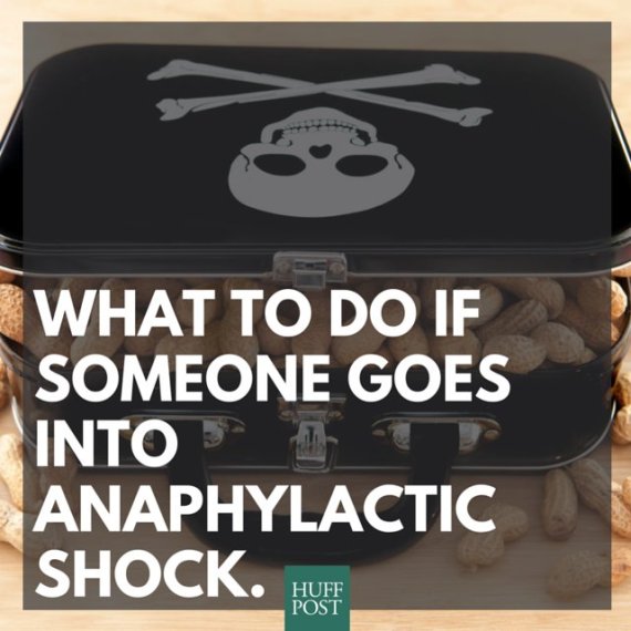 What To Do If Someone Has A Severe Allergic Reaction O-ANAPHYLACTIC-SHOCK-570