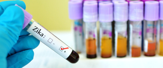 ZIKA