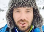 Ben Cohen Shares Snap Of Painful-Looking 'The Jump' Injury