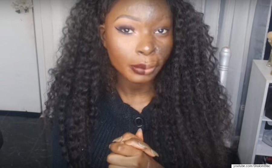This beauty YouTuber is also a burns survivor
