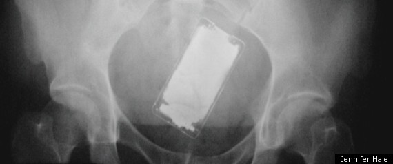 New Book Looks At X Rays Of Objects Stuck In Patients Orifices Photos 1954