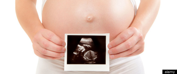 Rise In Ivf Treatment Recorded