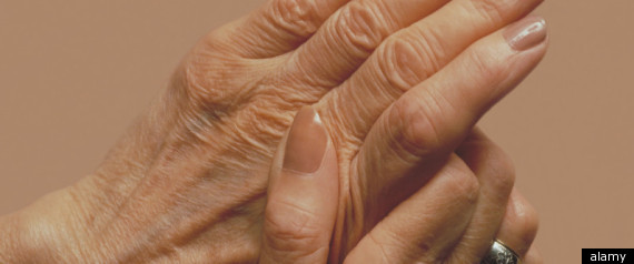 Mirror Therapy Arthritis Pain