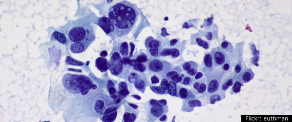 Cancer Cell