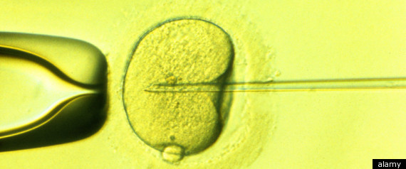 Ivf