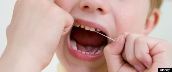 Overcrowded Teeth