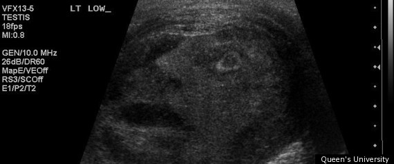 Face In Tumour