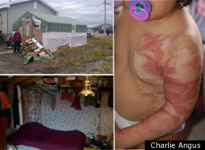 Http://i.huffpost.com/gen/417051/thumbs/sattawapiskatreservecharlieangusemergencylarge300.jpg