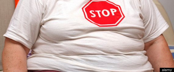 Women Obesity