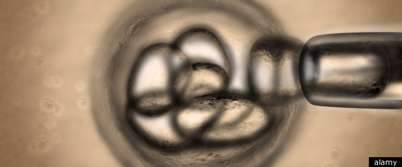 Stem Cell