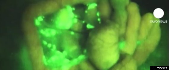 Green Glowing Cancer Spray