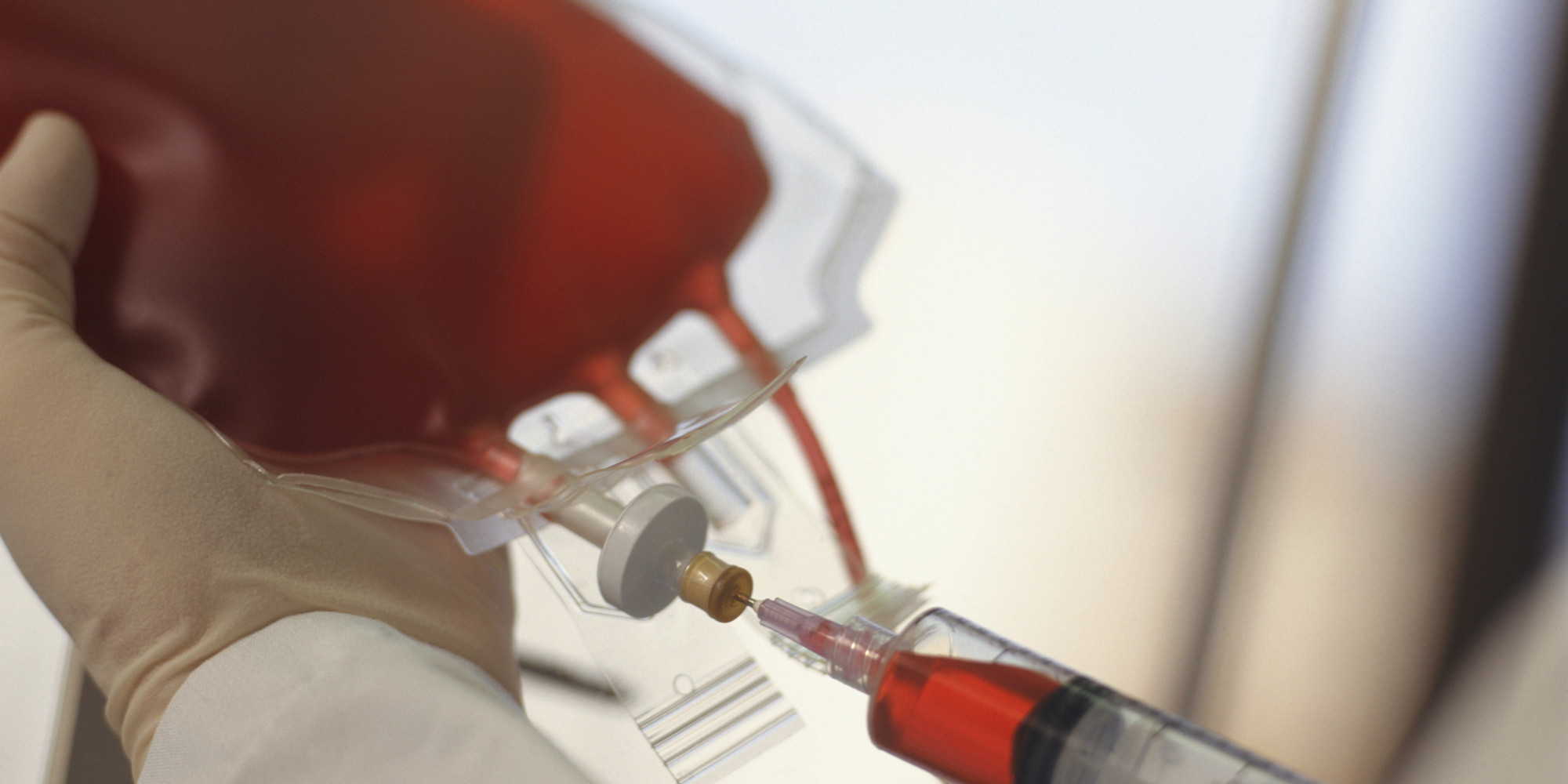 2,234 Get HIV After Blood Transfusion In India In 17 Months