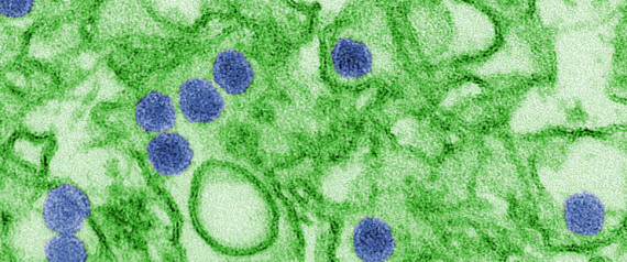 ZIKA