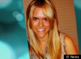 Model Who Walked Into Plane Propeller Has Eye Removed