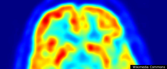 Brain