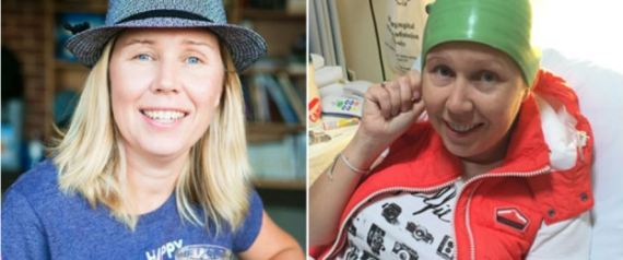 Lhuile pour les cheveux contre la chute lhuile dépicéa
