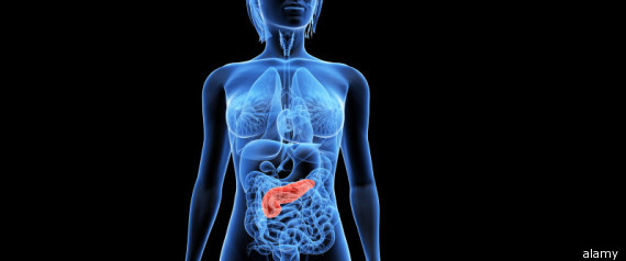 Nickel And Selenium Cut Risk Of Pancreatic Cancer