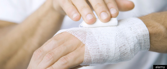 cleaning wounds maggots clean wounds that don t easily heal study shows cleaning wounds maggots clean wounds that don t easily heal study shows