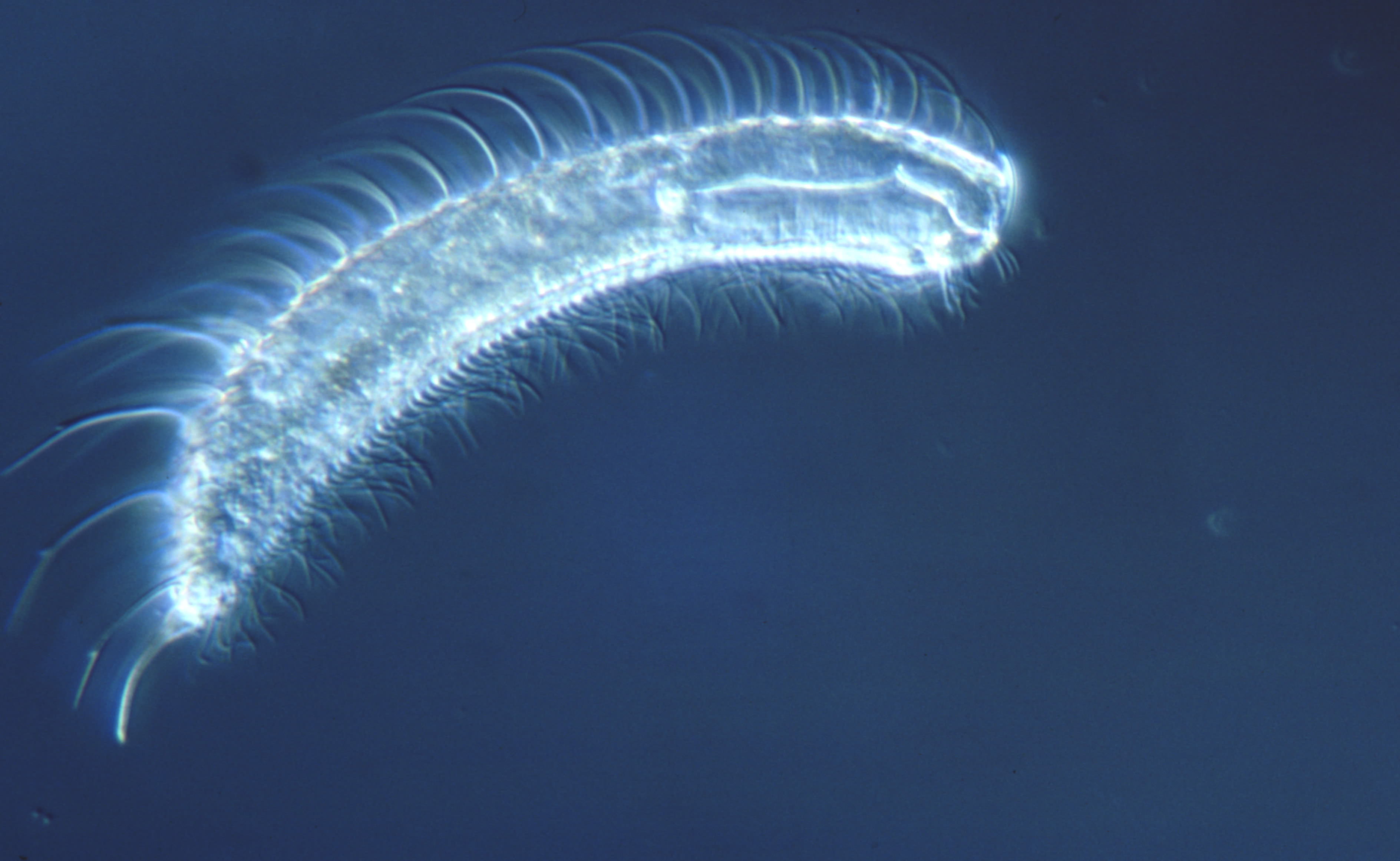 gastrotrichs