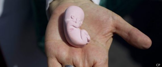 Abortion Canada Stephen Woodworth