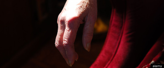 Limp Hand