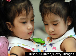 8 Most Amazing Successful Conjoined Twin Separations