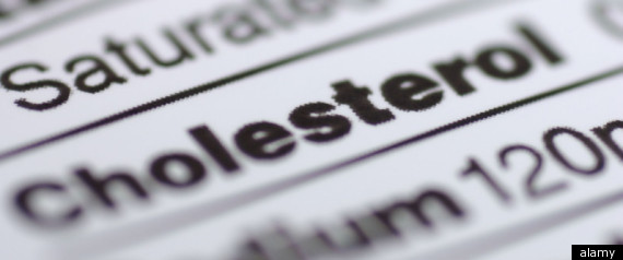Alnpcs Cholesterol