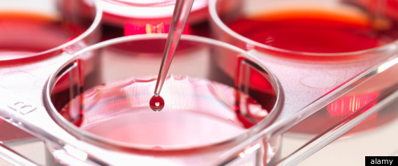 Stem Cells