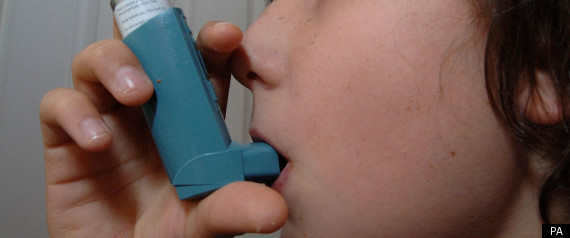Asthma