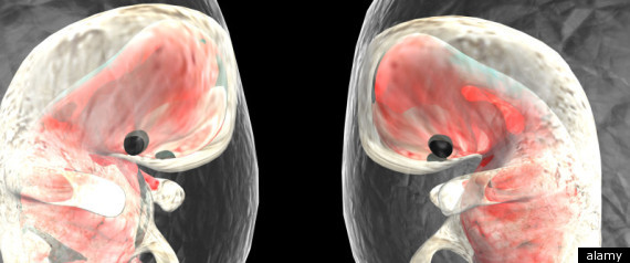 Two Embryos Better Than One Say Experts