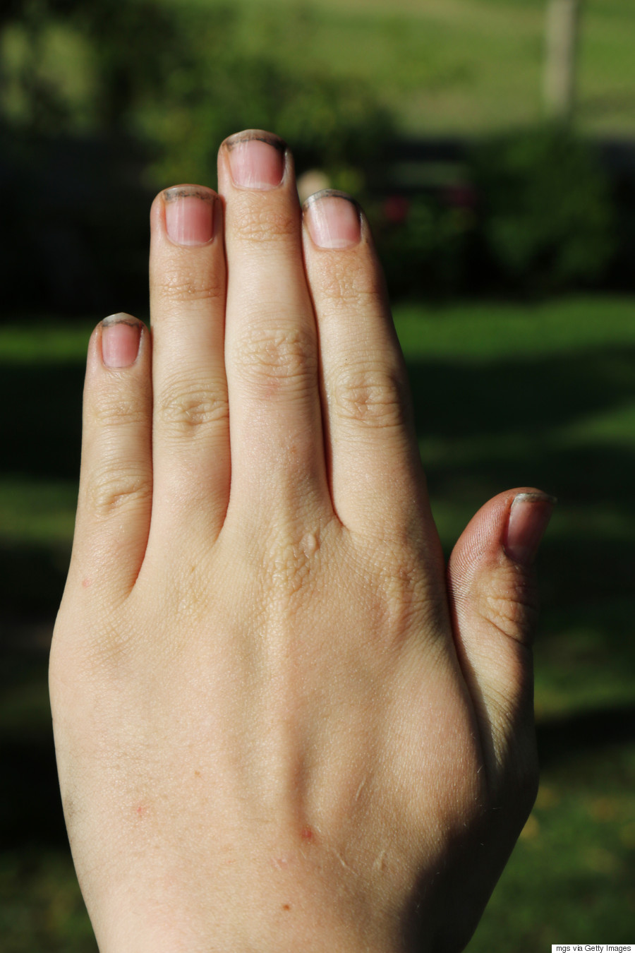 dirt nails