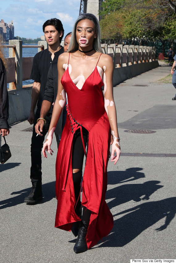 winnie harlow