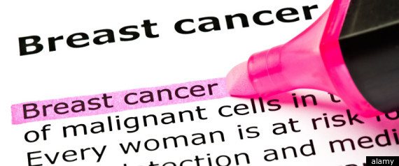 Fresh Doubt Over Hrt Link Breast Cancer