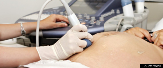 Ultrasound Woman