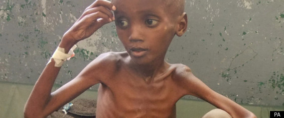 East Africa Famine