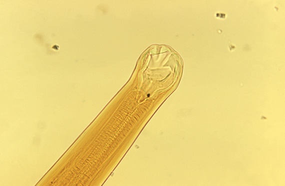 tapeworms